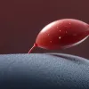 Al doilea caz de febră hemoragică Crimeea-Congo în Salamanca: Un bărbat infectat de o mușcătură de căpușă